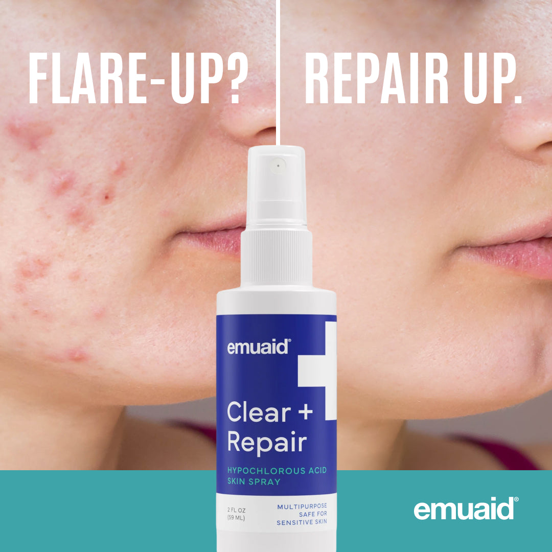 EMUAID Clear + Repair - Spray cutaneo all'acido ipocloroso
