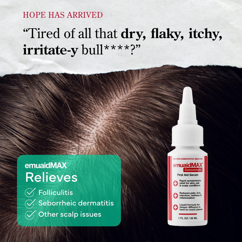 EMUAIDMAX Siero EMUAIDMAX di primo soccorso per la psoriasi del cuoio capelluto EMUAIDMAX Siero EMUAIDMAX di primo soccorso per la psoriasi del cuoio capelluto