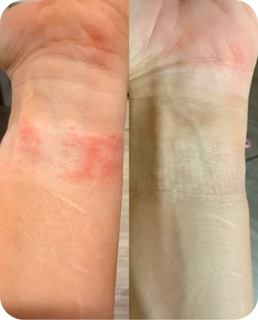 Risultati dello studio clinico