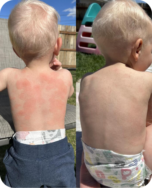 Risultati dello studio clinico