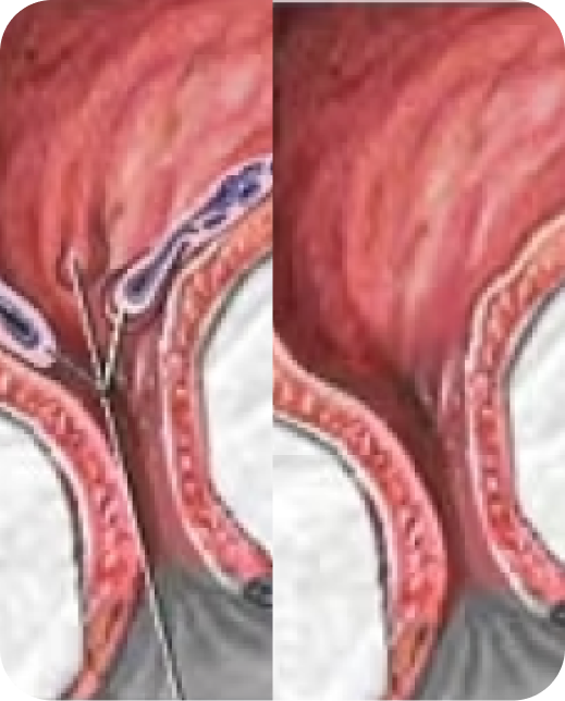 Risultati dello studio clinico