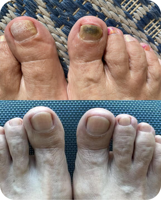 Risultati dello studio clinico