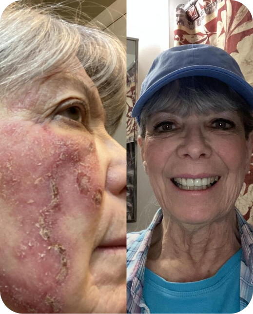 Risultati dello studio clinico