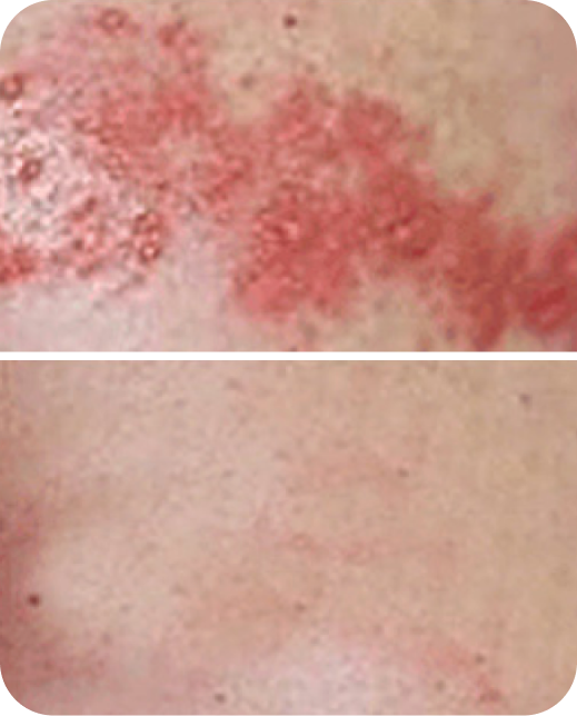 Risultati dello studio clinico