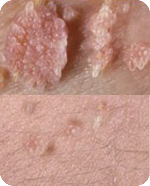 Risultati dello studio clinico