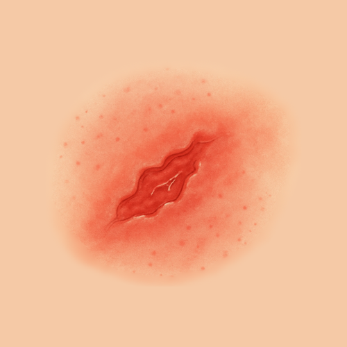 Immagine disegnata di una ferita