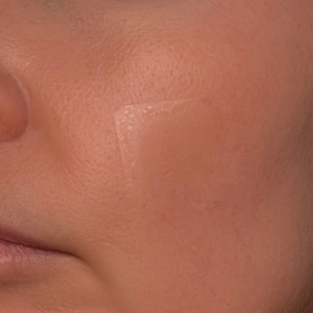 Cerotti EMUAIDMAX Cerotti EMUAIDMAX