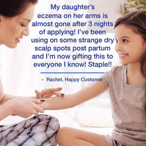 Testimonianza di un cliente felice sulla crema per il sollievo dall'eczema