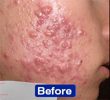 Risultati dello studio clinico