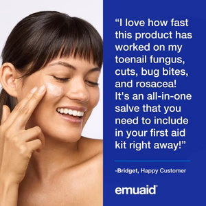Donna che applica una pomata con testimonial su sfondo blu