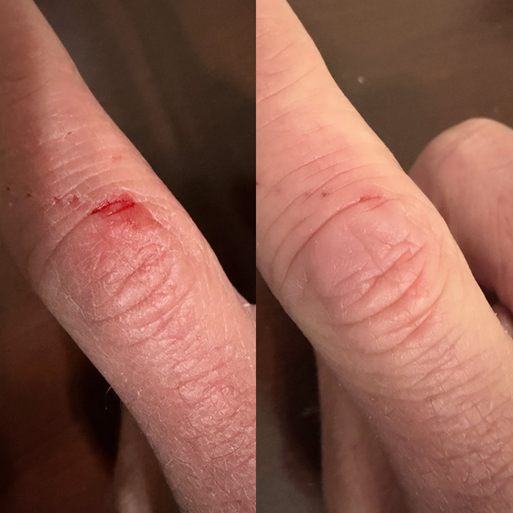 Cerotti EMUAIDMAX Cerotti EMUAIDMAX