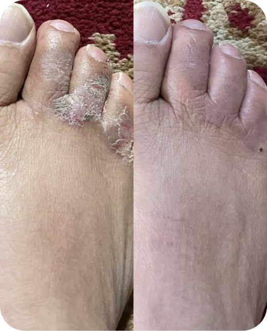 Risultati dello studio clinico