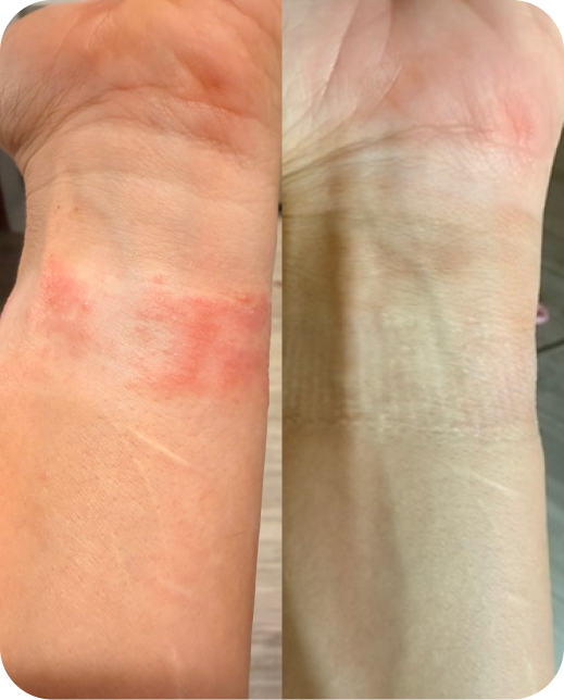 Risultati dello studio clinico