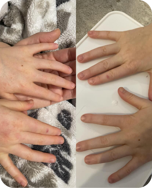 Risultati dello studio clinico