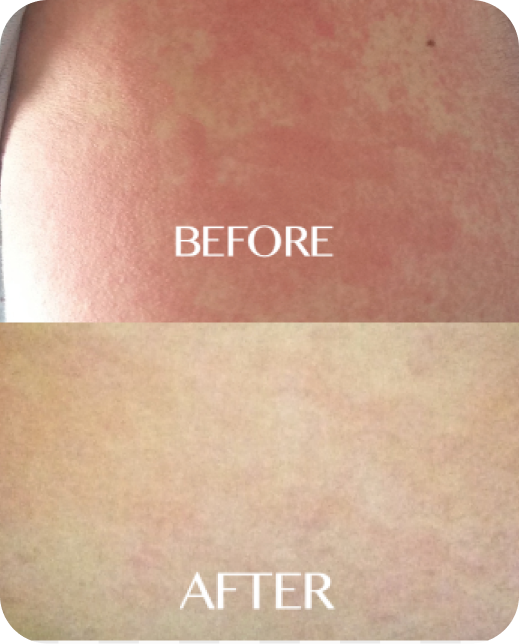 Risultati dello studio clinico