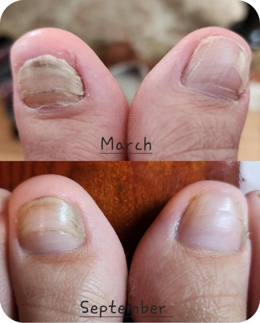 Risultati dello studio clinico