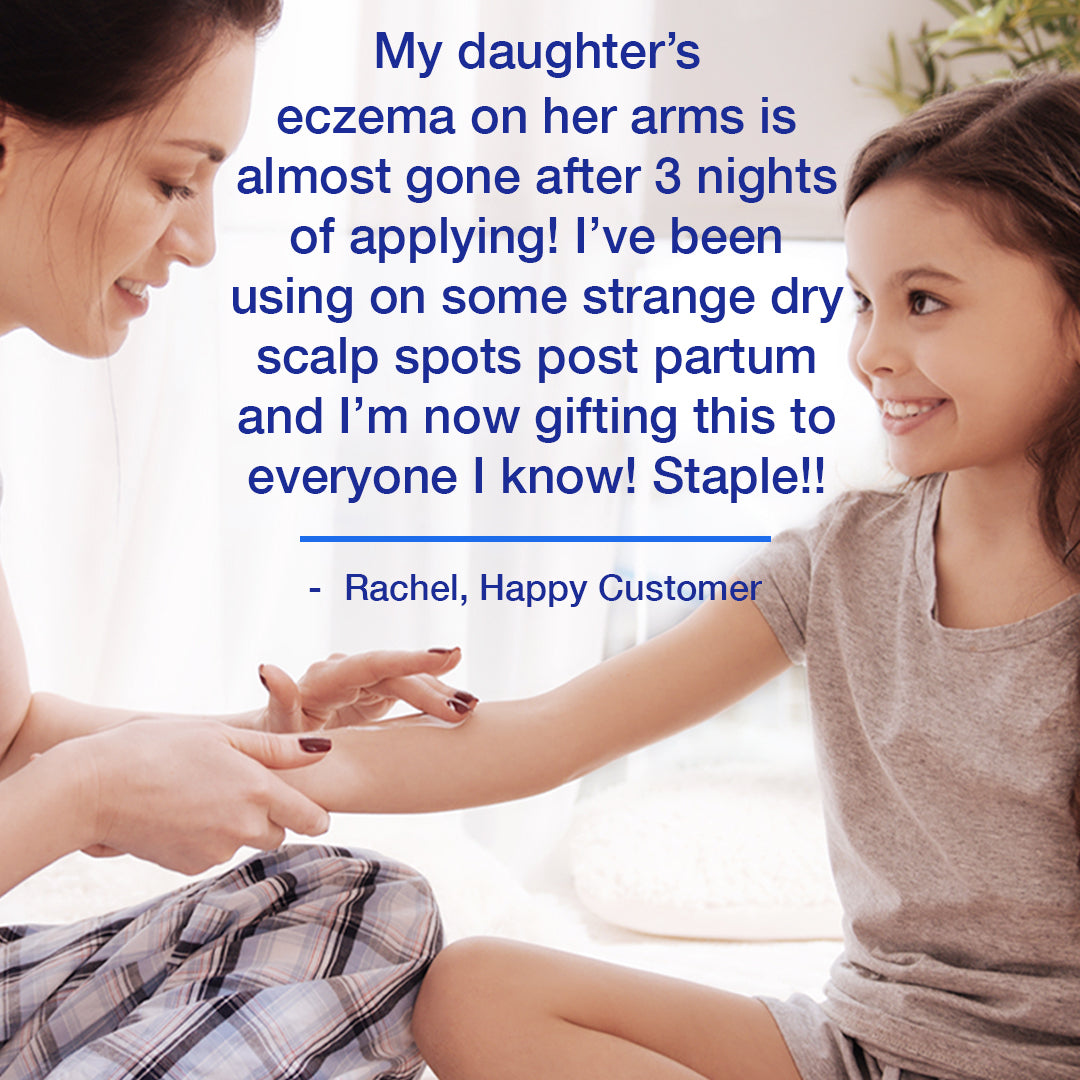 Testimonianza di un cliente felice sulla crema per il sollievo dall'eczema