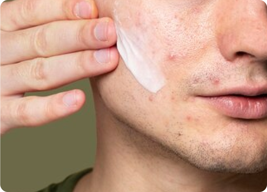 EMUAID Sistema per eliminare EMUAID
